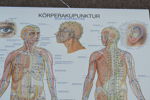 2 Affischer. Medicinskt öra Kina & Body Acupuncture.